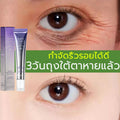 Eye cream 20g bag eye cream, wrinkles eye cream, eye cream, reducing bag eye cream, black eyeliner, eye cream, eye cream, eye cream, eye cream, eye cream, eye cream, eye cream black remove foot cream eye cream