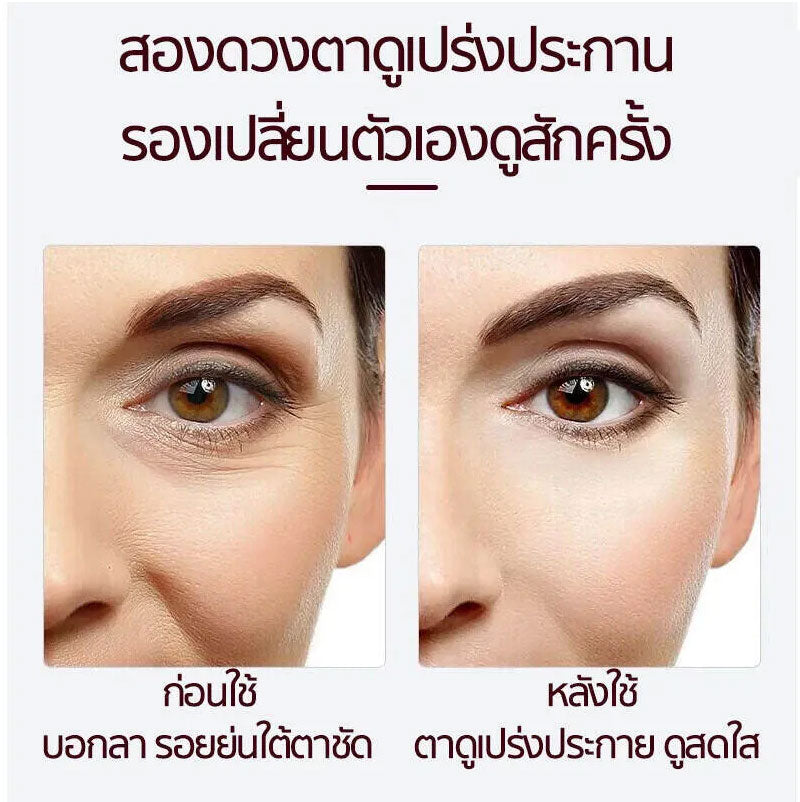 Eye cream 20g bag eye cream, wrinkles eye cream, eye cream, reducing bag eye cream, black eyeliner, eye cream, eye cream, eye cream, eye cream, eye cream, eye cream, eye cream black remove foot cream eye cream