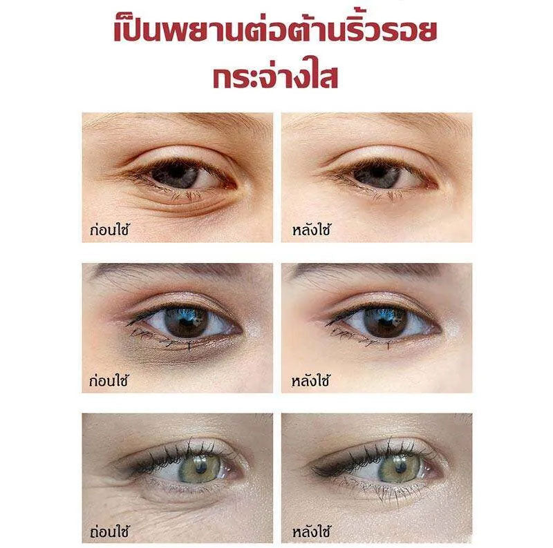 Eye cream 20g bag eye cream, wrinkles eye cream, eye cream, reducing bag eye cream, black eyeliner, eye cream, eye cream, eye cream, eye cream, eye cream, eye cream, eye cream black remove foot cream eye cream